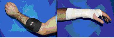 elbow