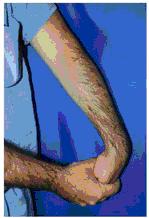 elbow